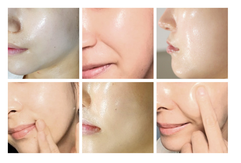 CIVASAN NEW Balsam Kit