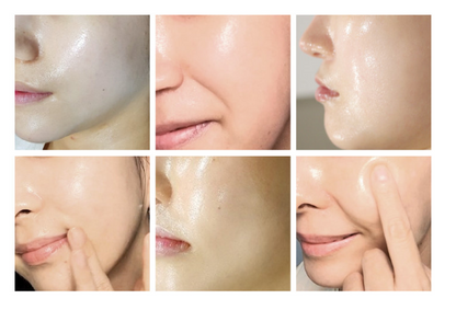 CIVASAN NEW Balsam Kit